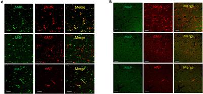 Comparison of Anti-oncotic Effect of TRPM4 Blocking Antibody in Neuron, Astrocyte and Vascular Endothelial Cell Under Hypoxia